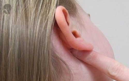 sakit kepala bagian belakang bawah telinga 16